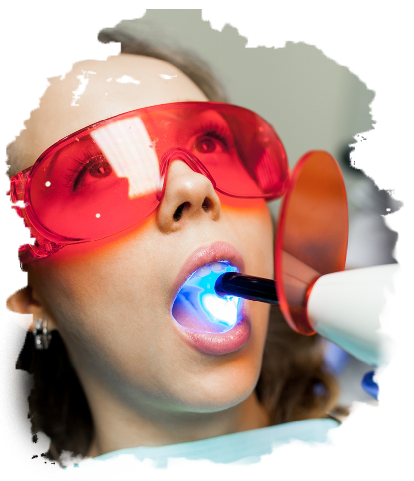 Diş Beyazlatma Kalıcı Mıdır