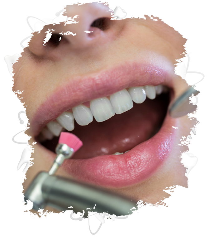 Diş Cilası Nedir, Ne İşe Yarar, Nasıl Kullanılır