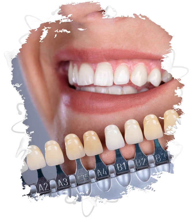 Lamine Dişlerin Bakımı ve Dayanıklılığı